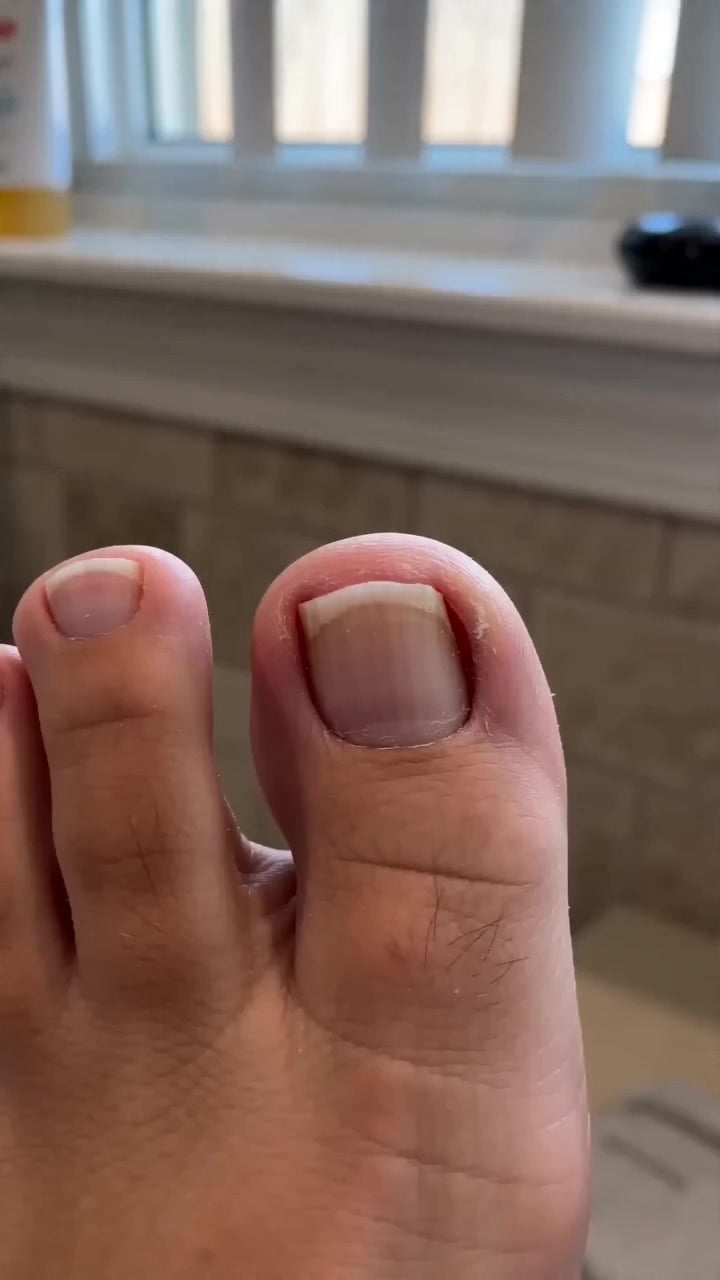The Last Nail Clipper You'll Ever Need