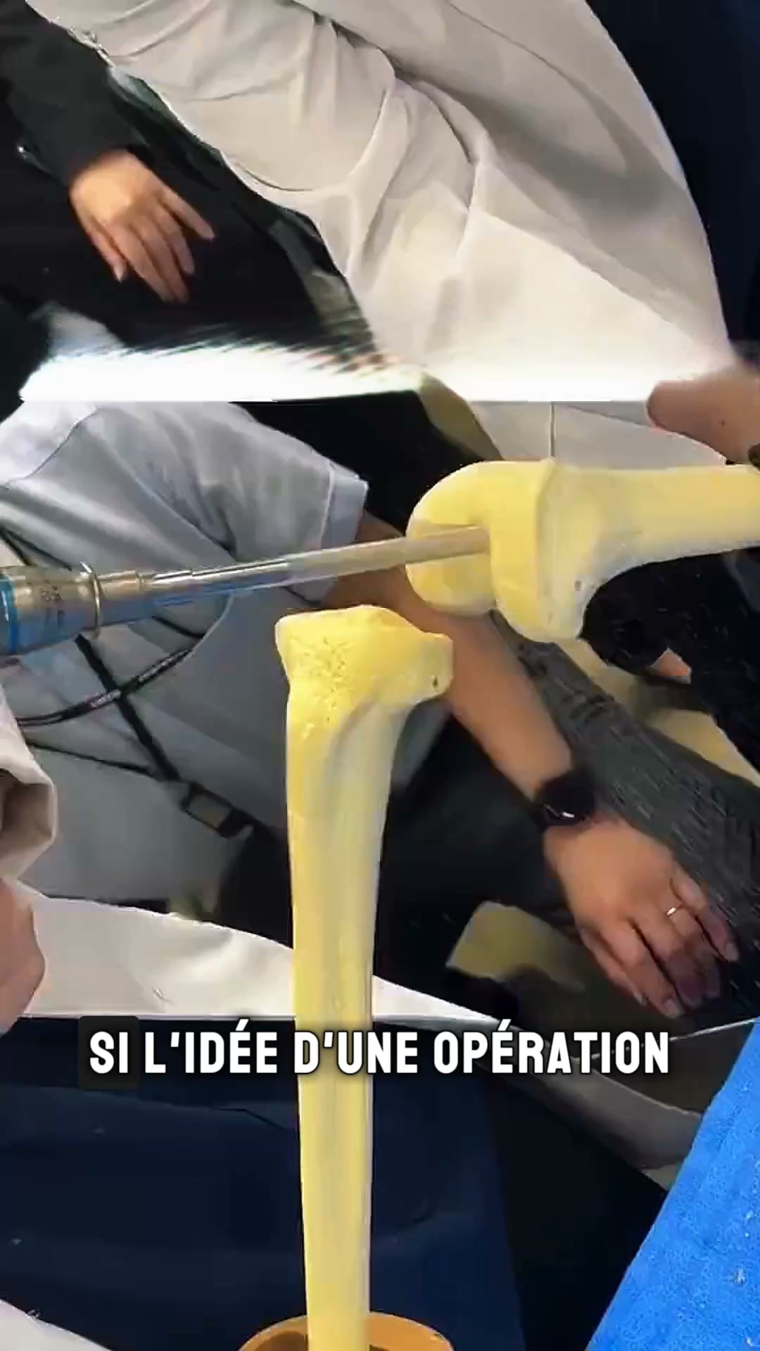 Douleurs au genou ou arthrose ?