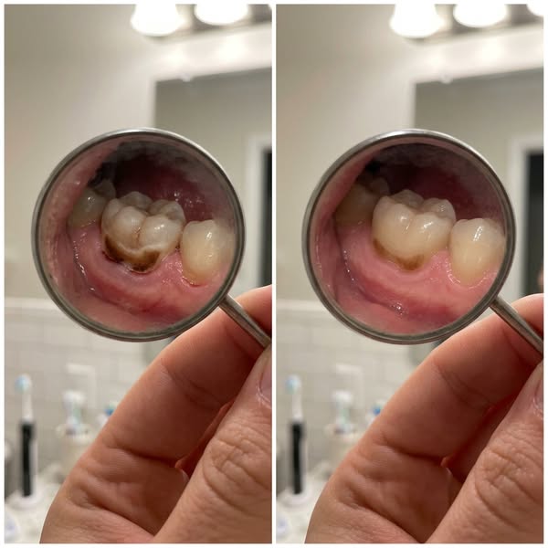 Your Teeth Can Repair Themselves. Here's How.