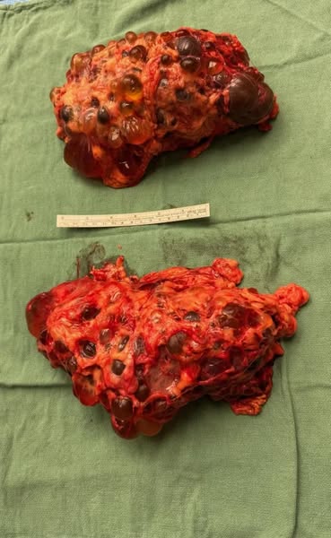 The Real Reason Your Kidney Supplements Aren't Working