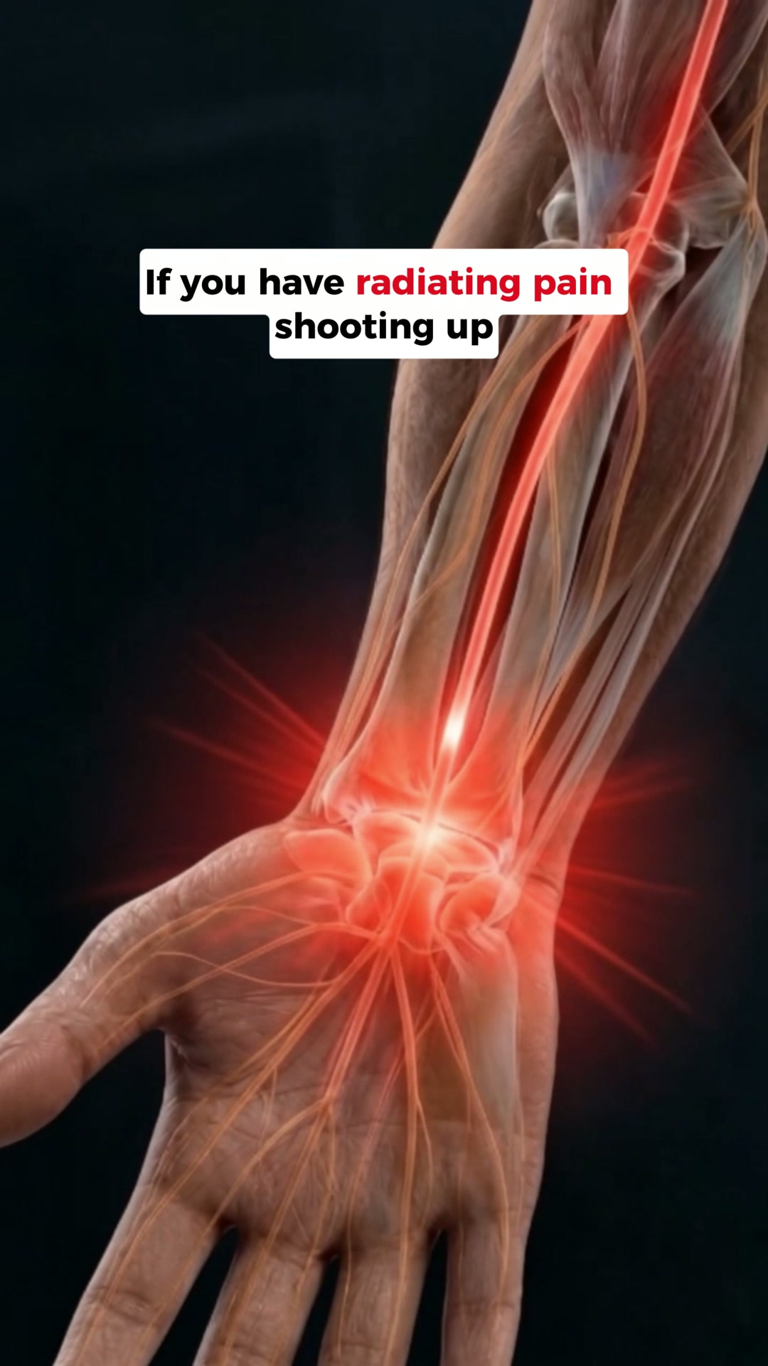 Wrist Pain Relief In Just 15 Minutes A Day