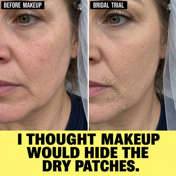 I’m getting married soon, and I finally feel good about my skin