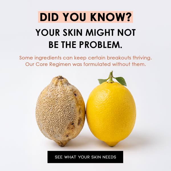 Maybe It Isn’t Just Stubborn Acne