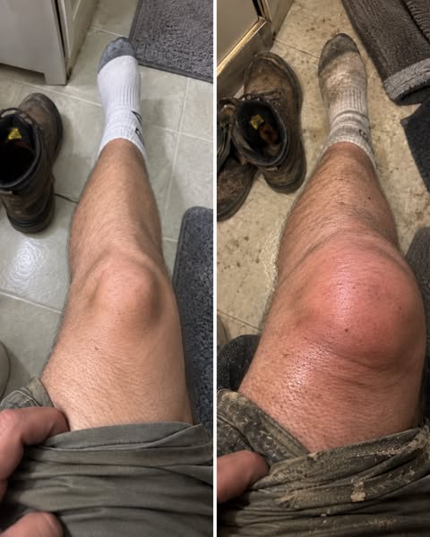 Tradesmen with knee pain, read this