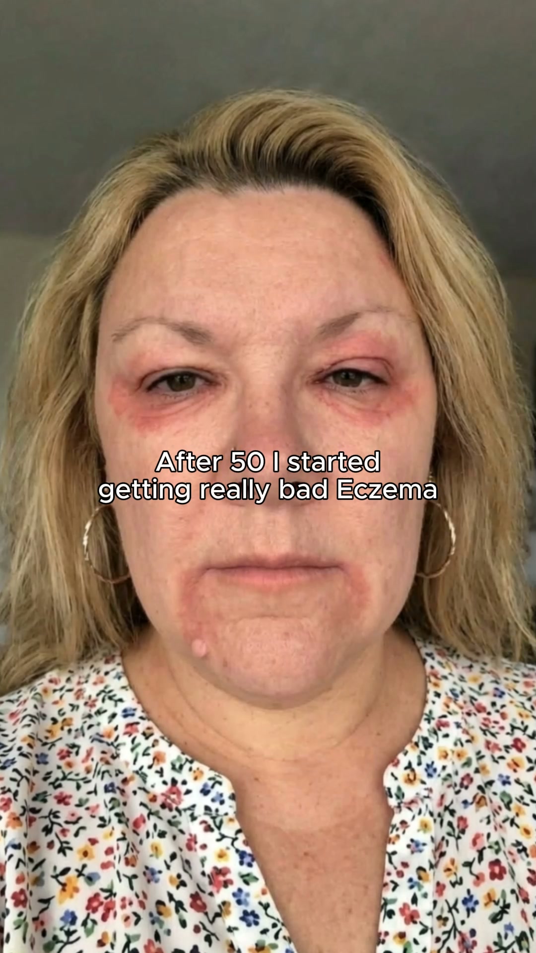 Restore Your Skin in 3 Weeks!