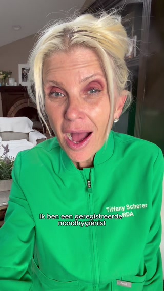 Je haar de hele dag omhoog? Je hoofdhuid betaalt de prijs