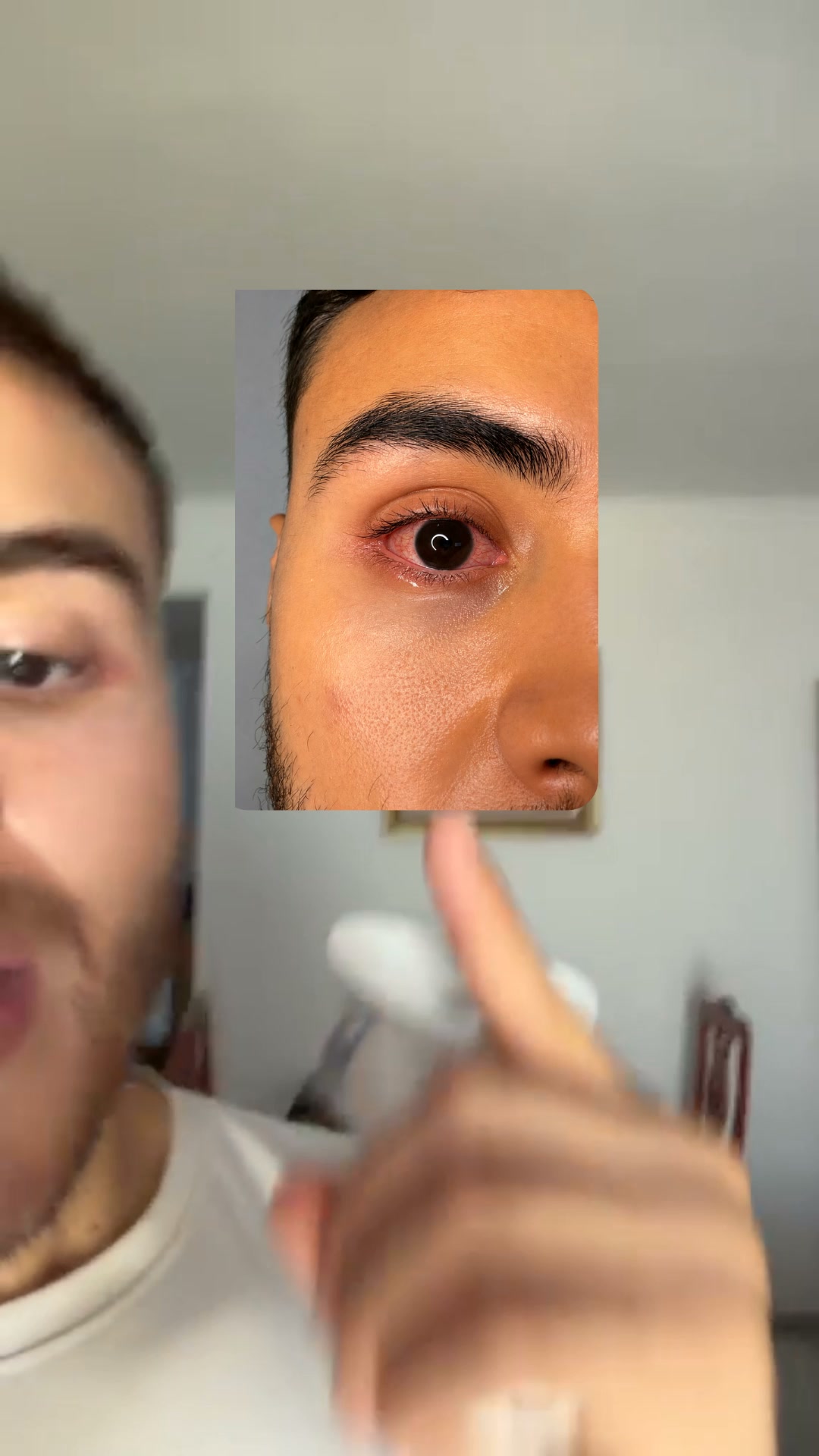 Solución en 5 minutos para el picor