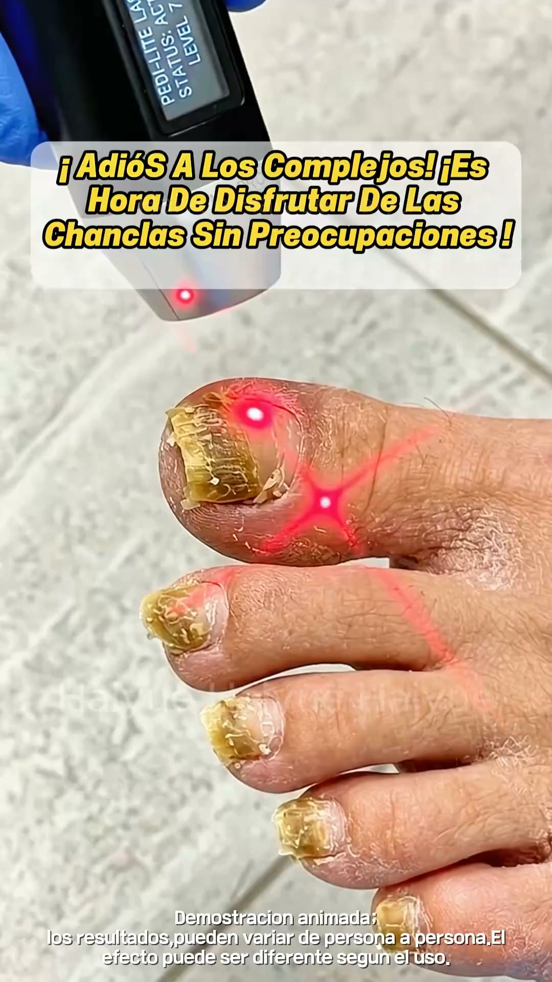 50% só HOJE