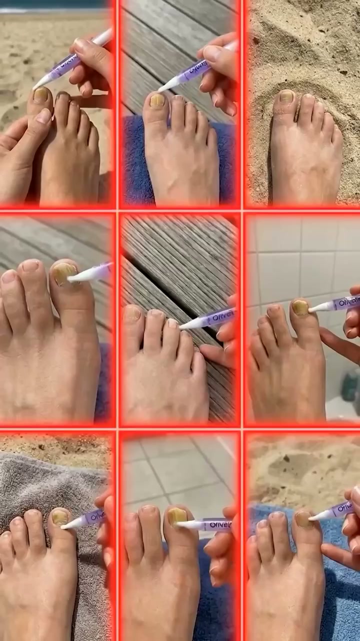 I Wasted Years on Creams That Failed