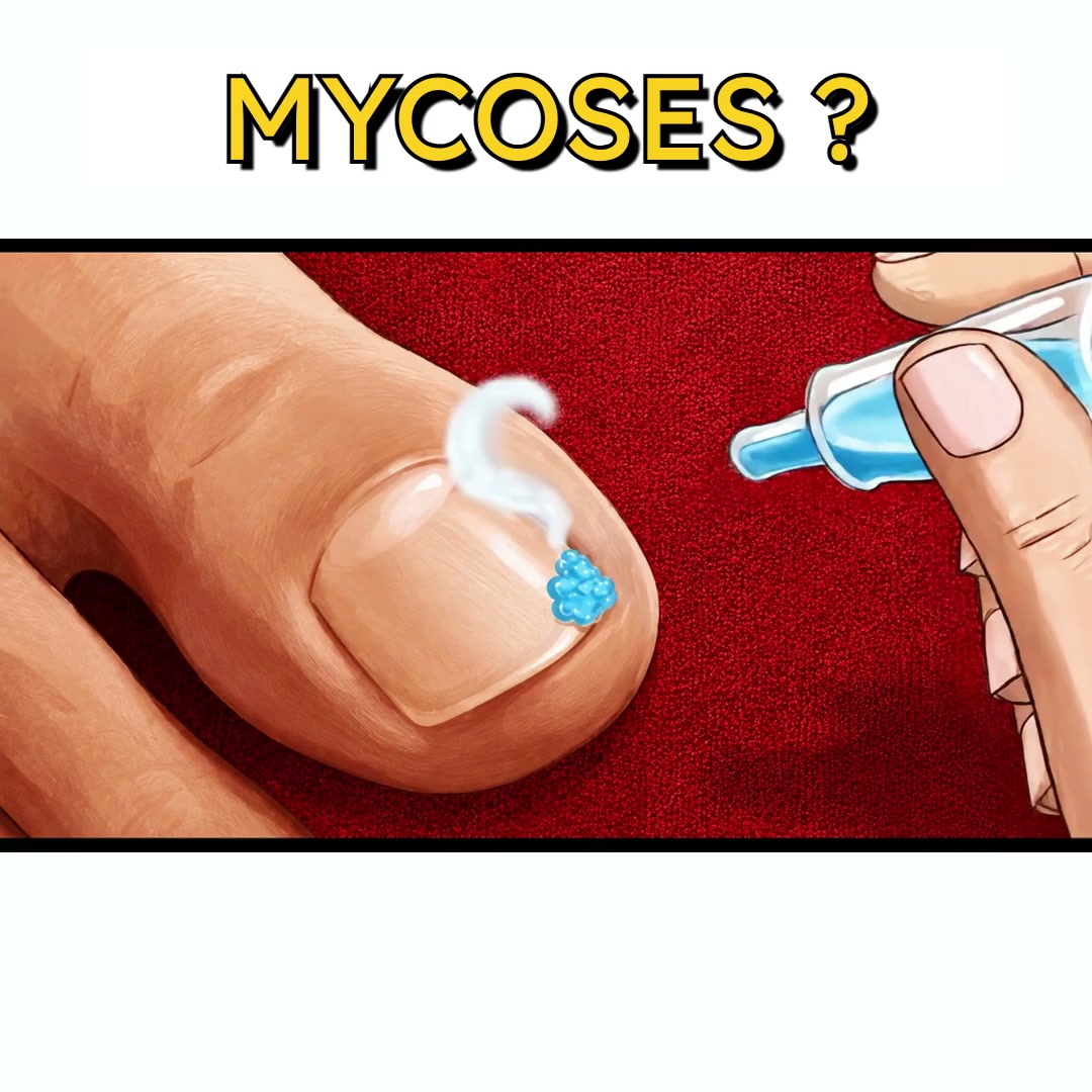 Ongles fragiles : une aide inattendue