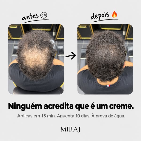 Cabelo ralo? Densidade visível em 15 minutos