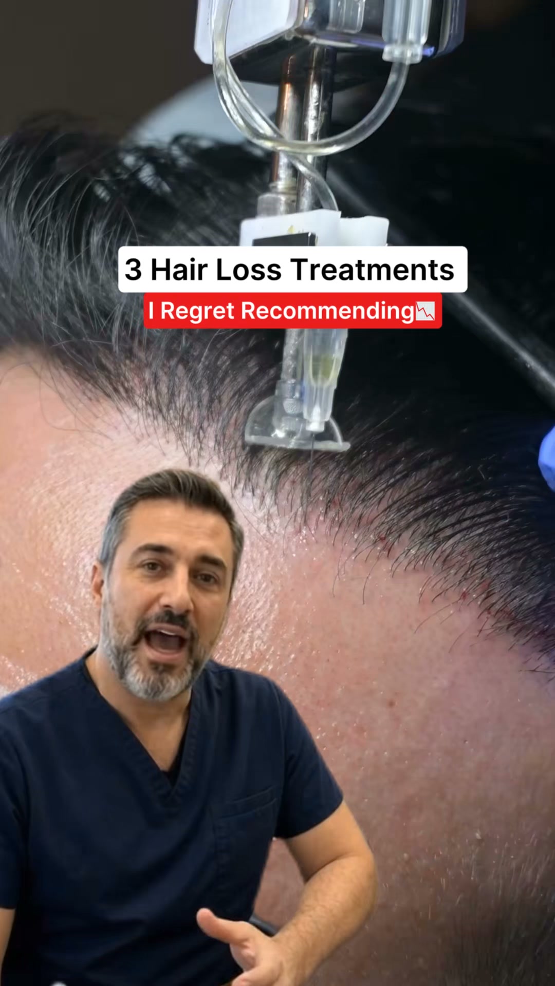 Expert Rates Hair Loss Solutions