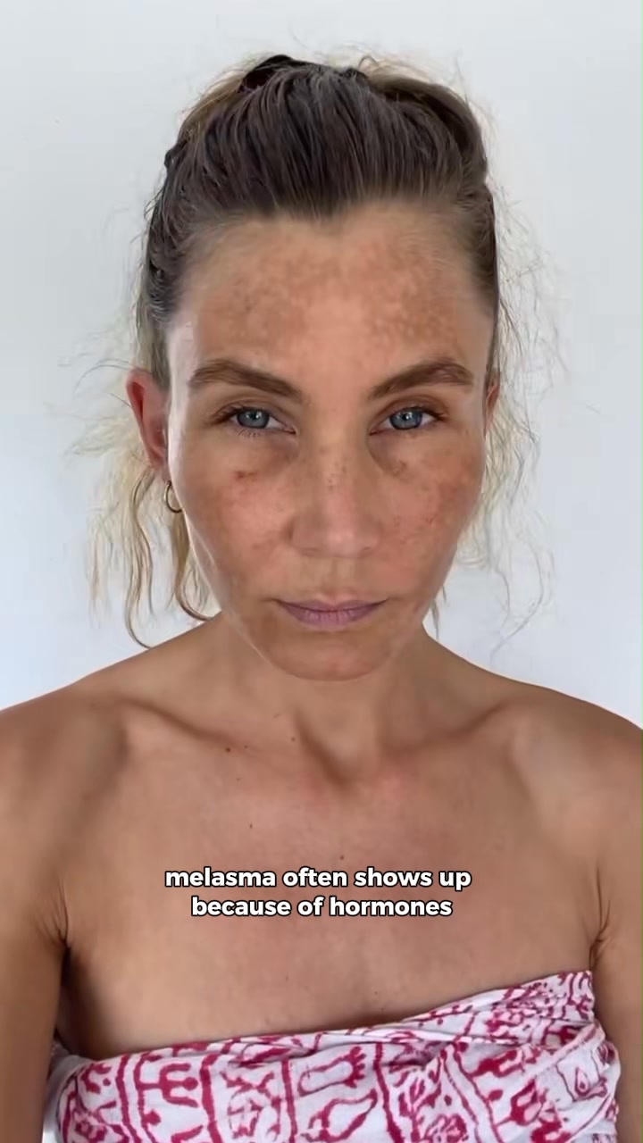 Bright Skin, Simplified