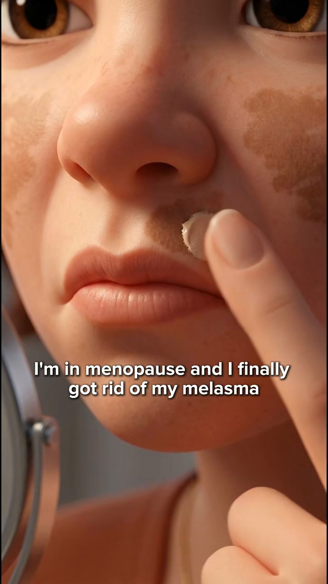Stop Covering Perimenopause Melasma With Makeup, Do This Instead