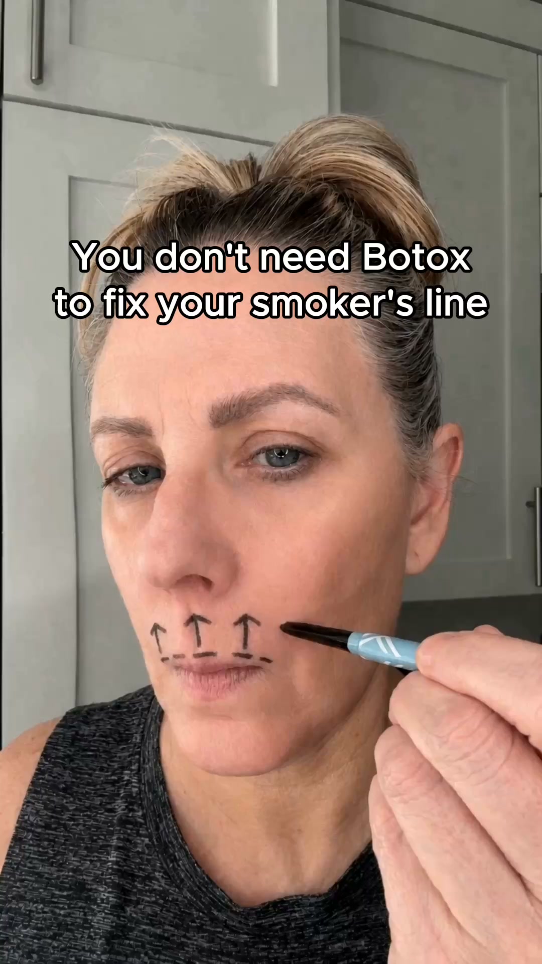 No needles. Just Smooth Skin.
