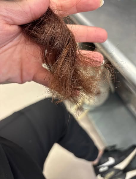 “‘What Happened to Your Hair?’ I Laughed It Off… But I Had No Idea Either.”
