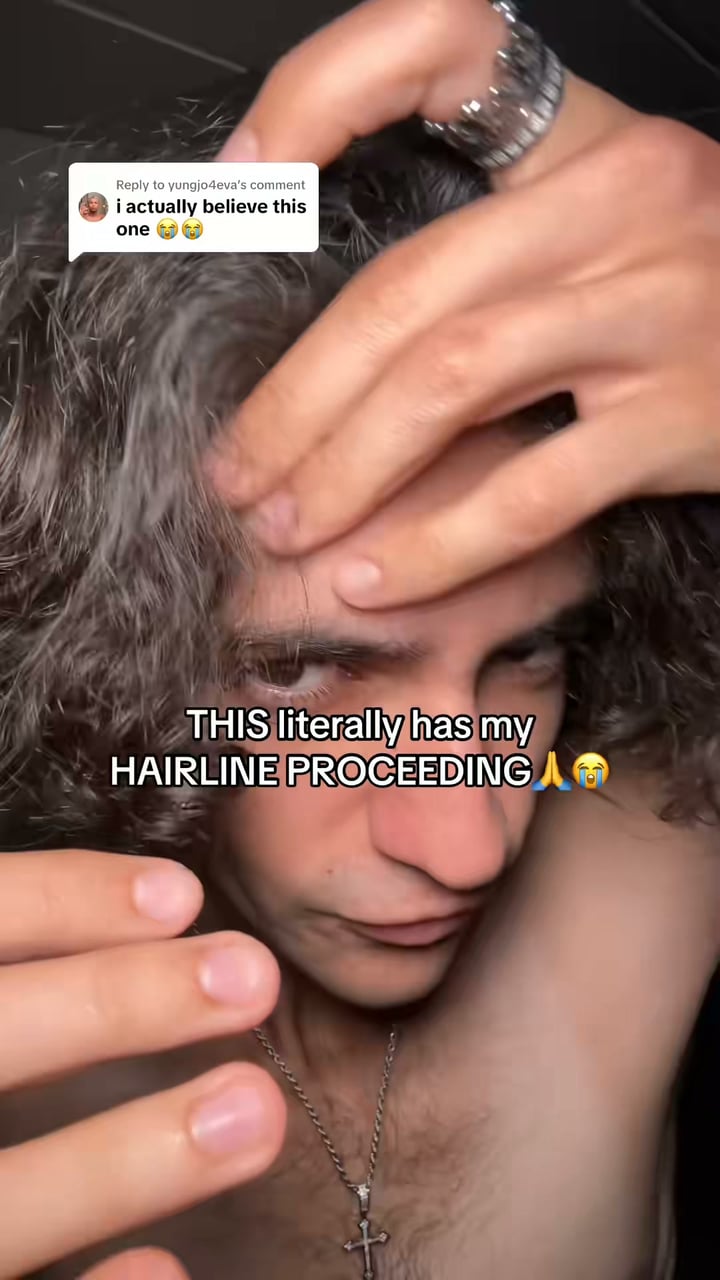 Hair thinning at the crown or temples?
