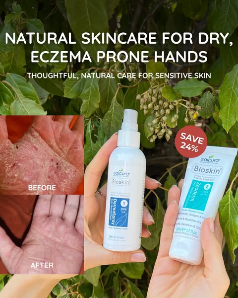 2-Step Spray-Cream Therapy System