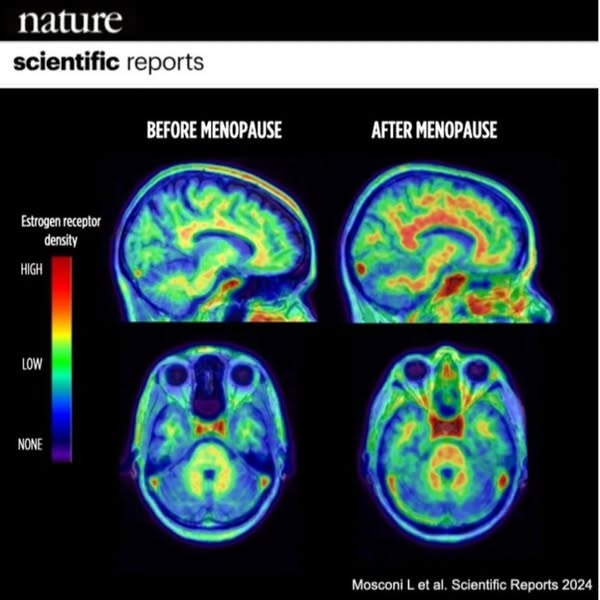 Read this if you have menopause brain