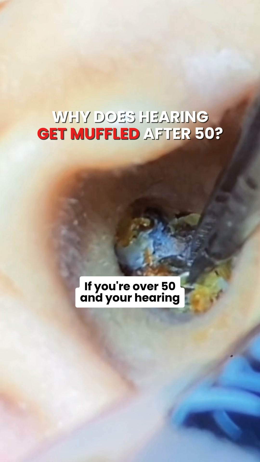 I Thought My Hearing Was Getting Worse With Age…