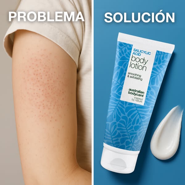 Di adiós a los bultitos secos sin cremas pesadas