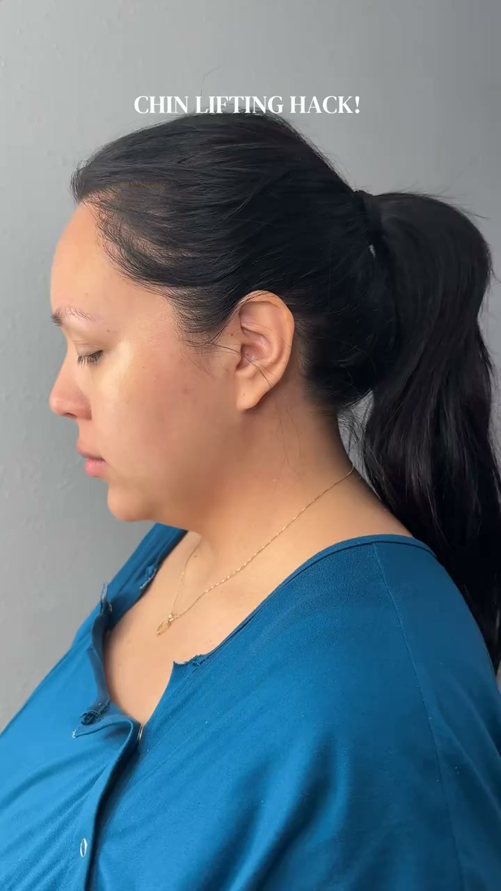 Loose Skin & a Soft Double Chin Ruining Your Side Profile? Refresh Your V-Line in 30 Minutes