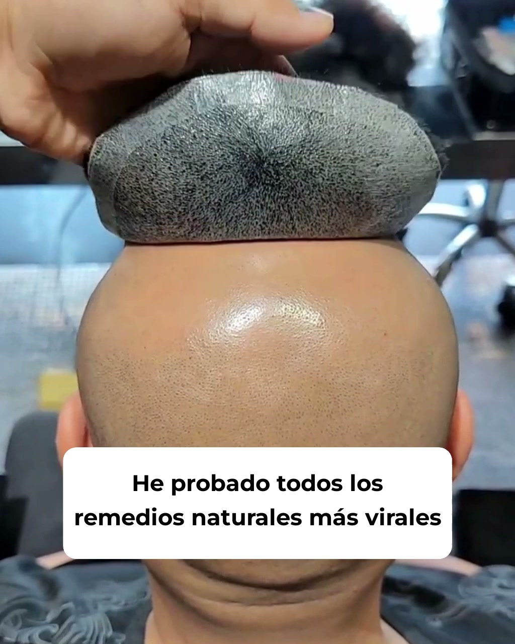 Reactiva tus folículos naturalmente