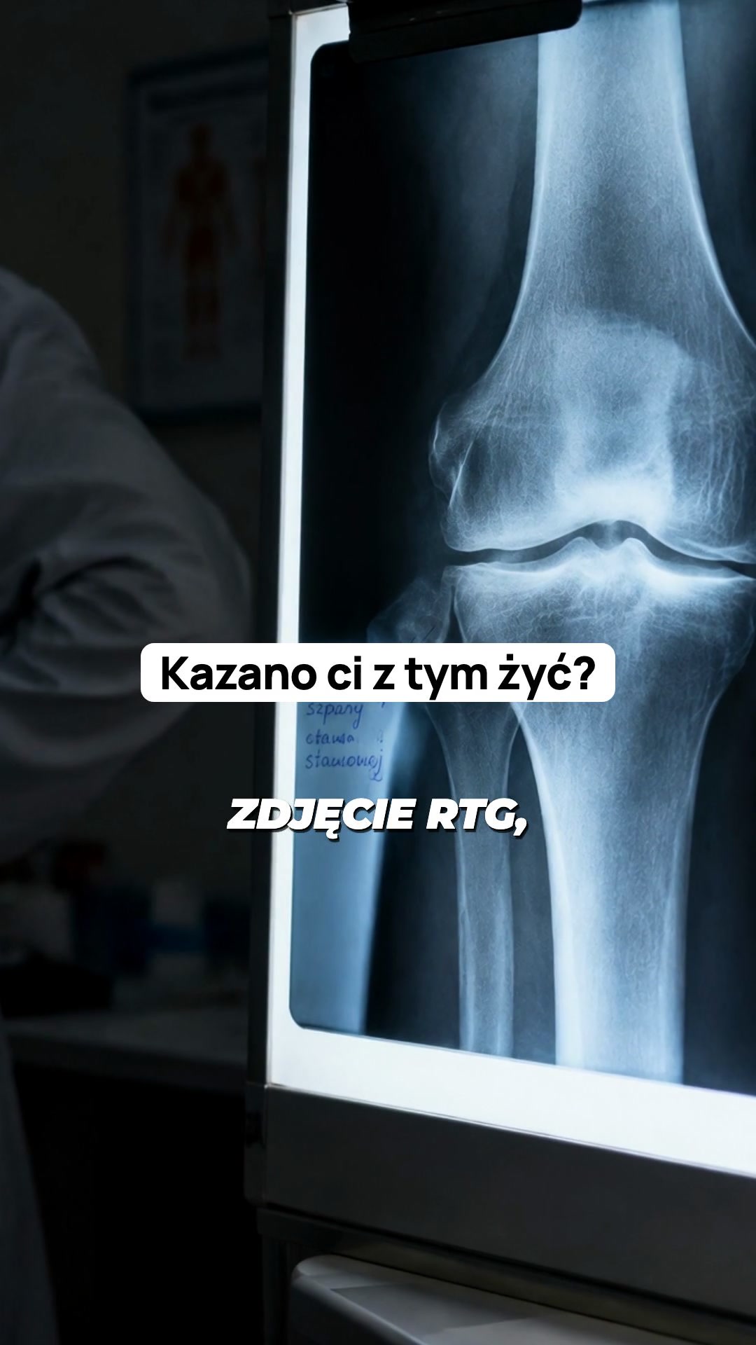Masz dość bolących pleców i kolan?