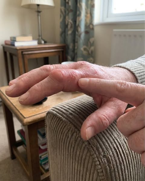The 7 Reasons Hand Pain Comes Back No Matter What You Do