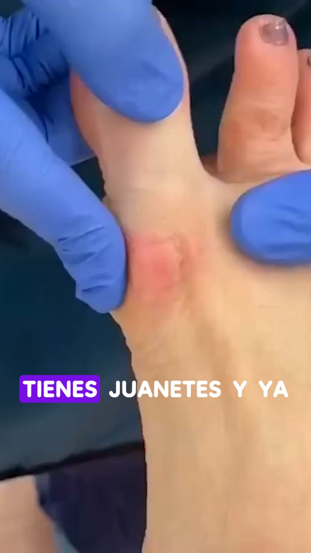 PAGO CONTRA REEMBOLSO