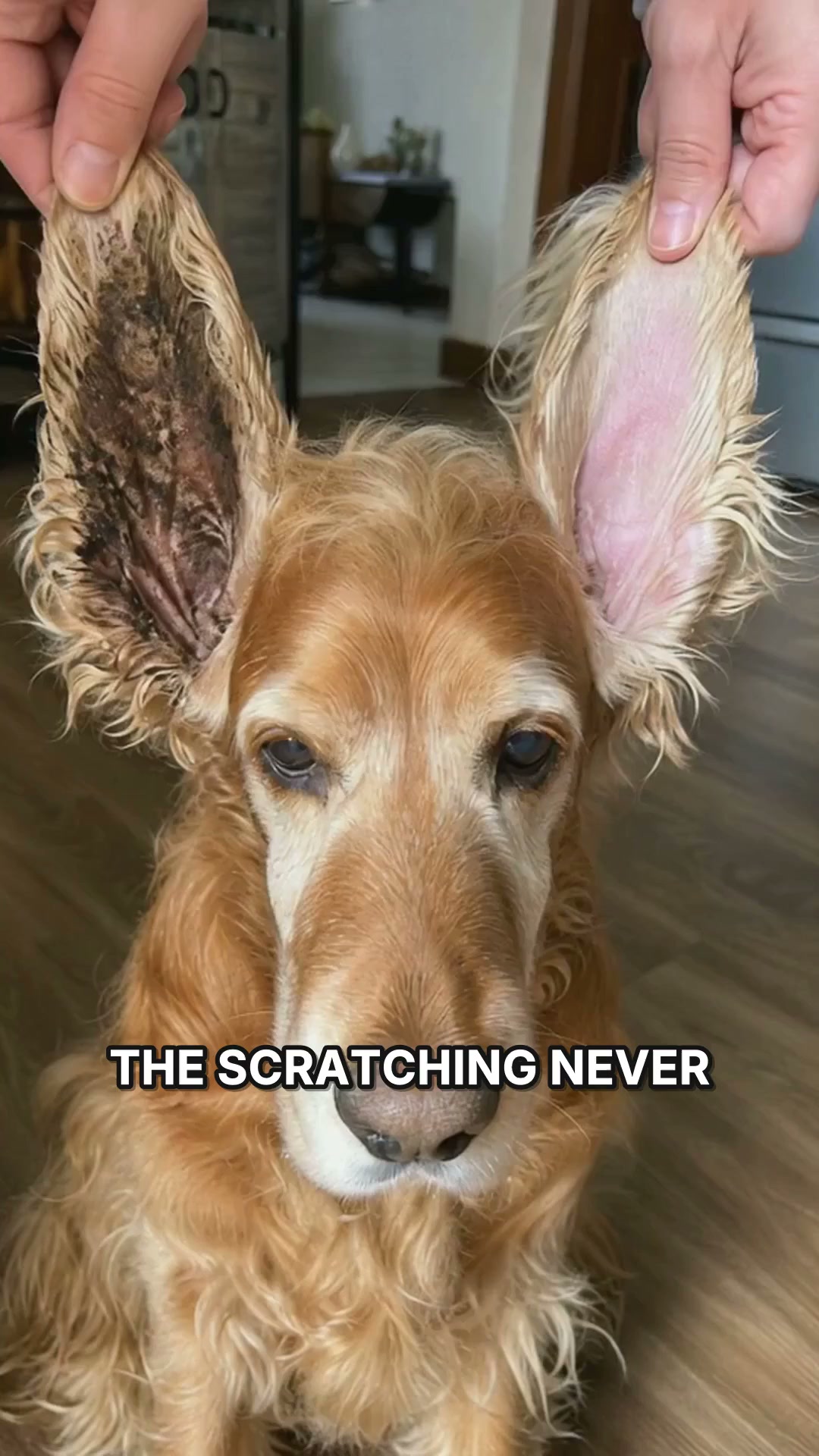 The Itch Stops Tonight, Not Next Month