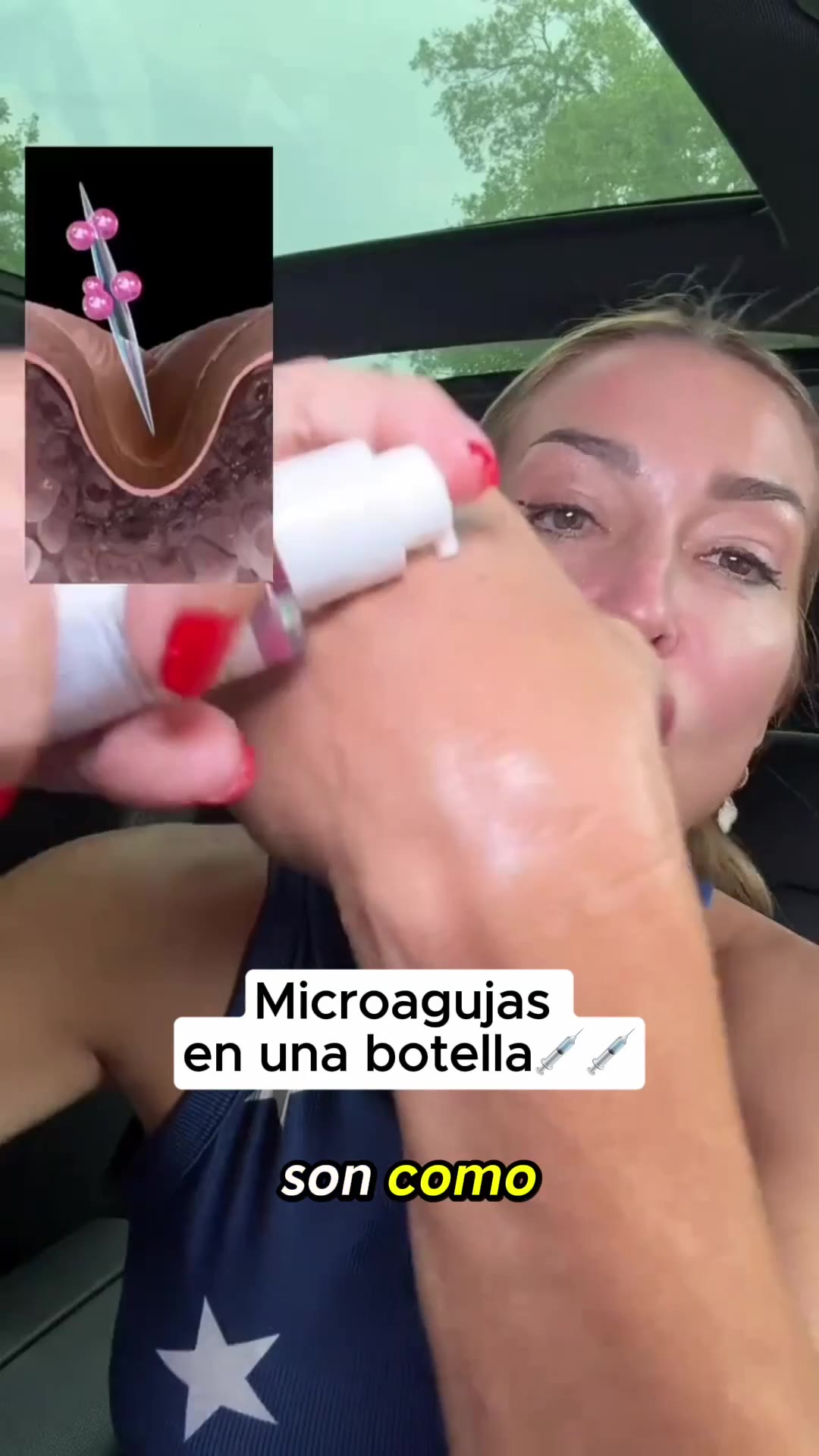 Las cinco cosas que nadie te explica