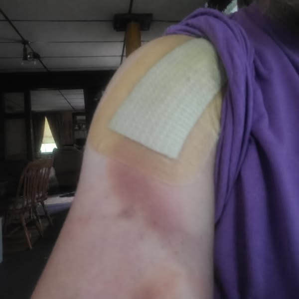 Best shoulder surgery sleeve