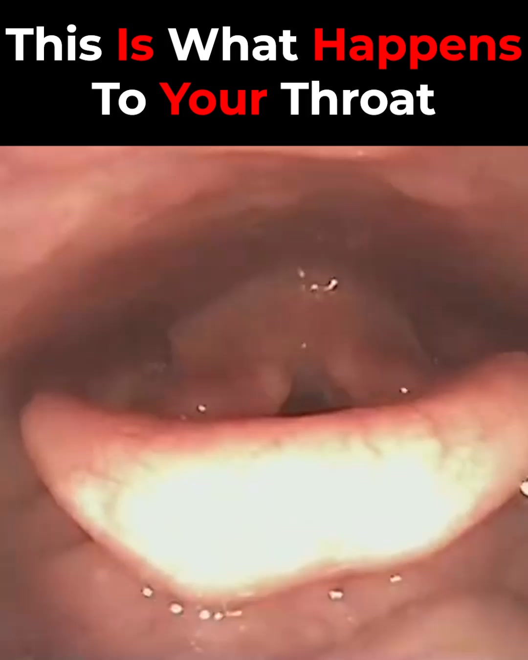 Fix Snoring & Sleepless Nights