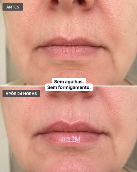 FerméLuxe – Sérum Labial para Lábios Mais Cheios – ..