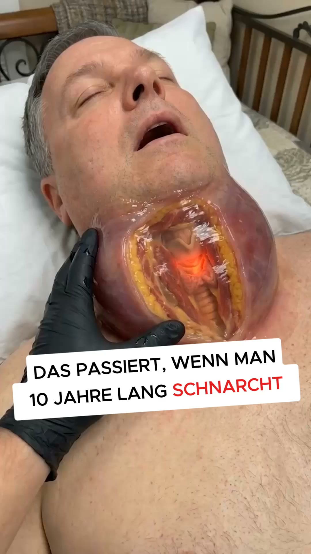 Der intelligentere Weg, um Schnarchen zu stoppen!