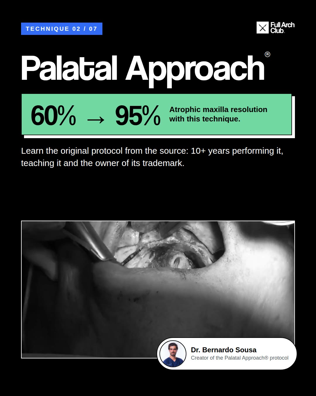 FULL ARCH CLUB - Implant Dentistry
