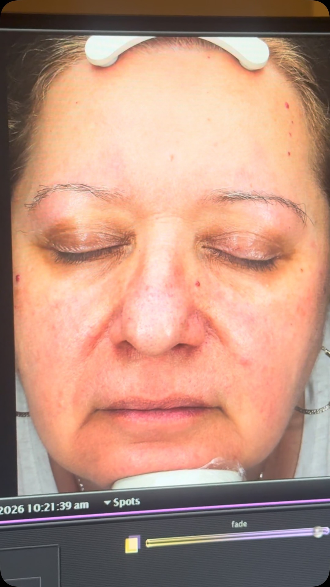 Anúncio de Dermalaser Skin Boutique