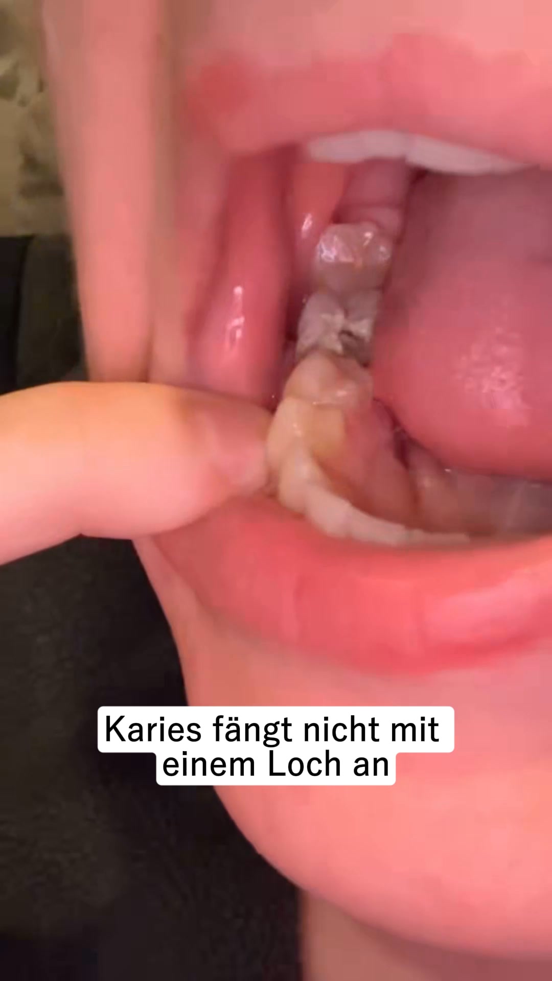 1 Kaugummi, der deine Zähne verändert.