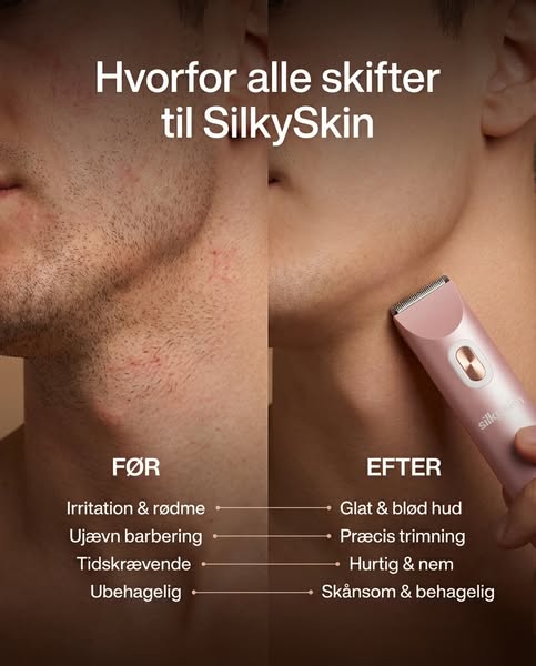 Slip for barberknopper for altid