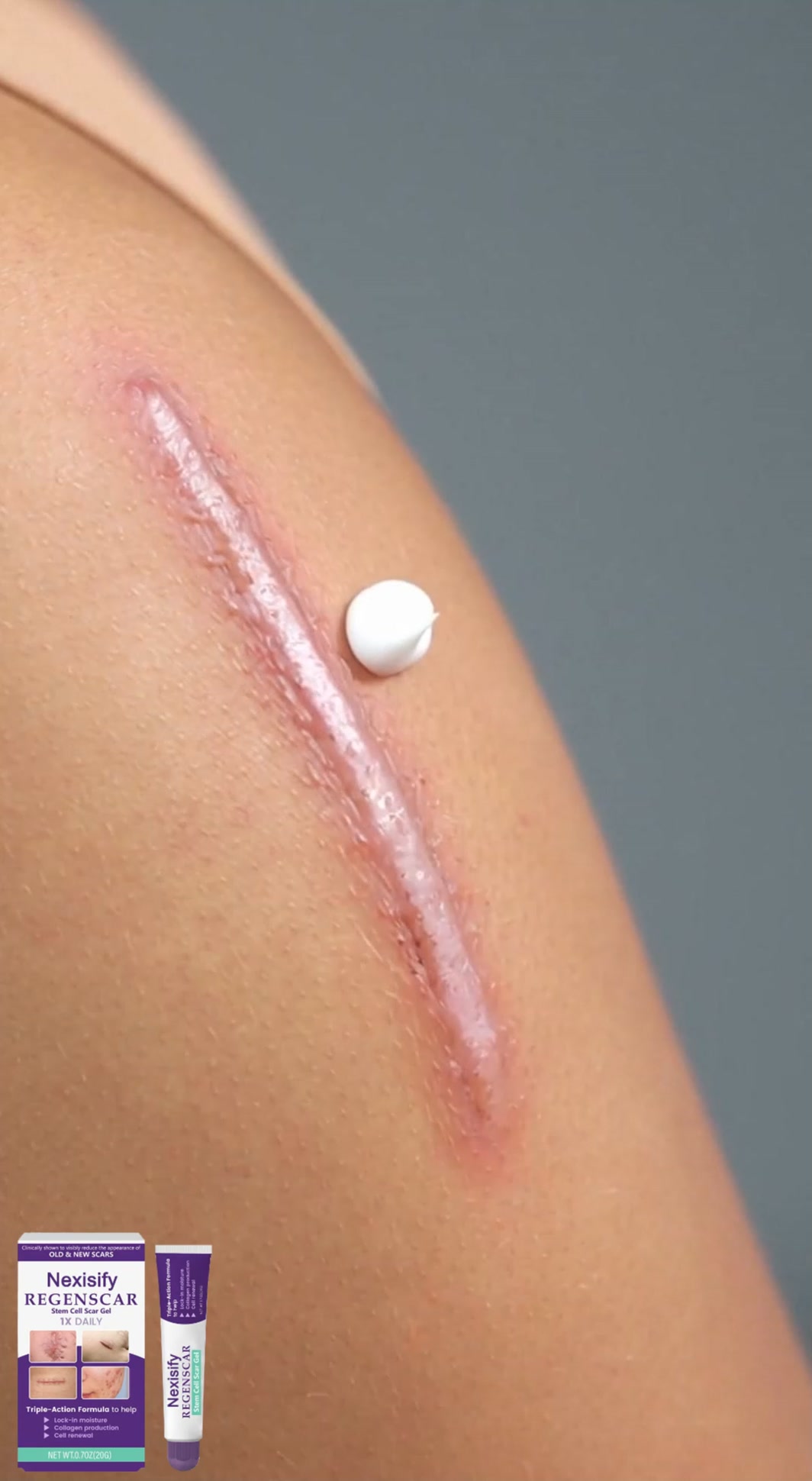 Say Goodbye to Stubborn Old & New Scars