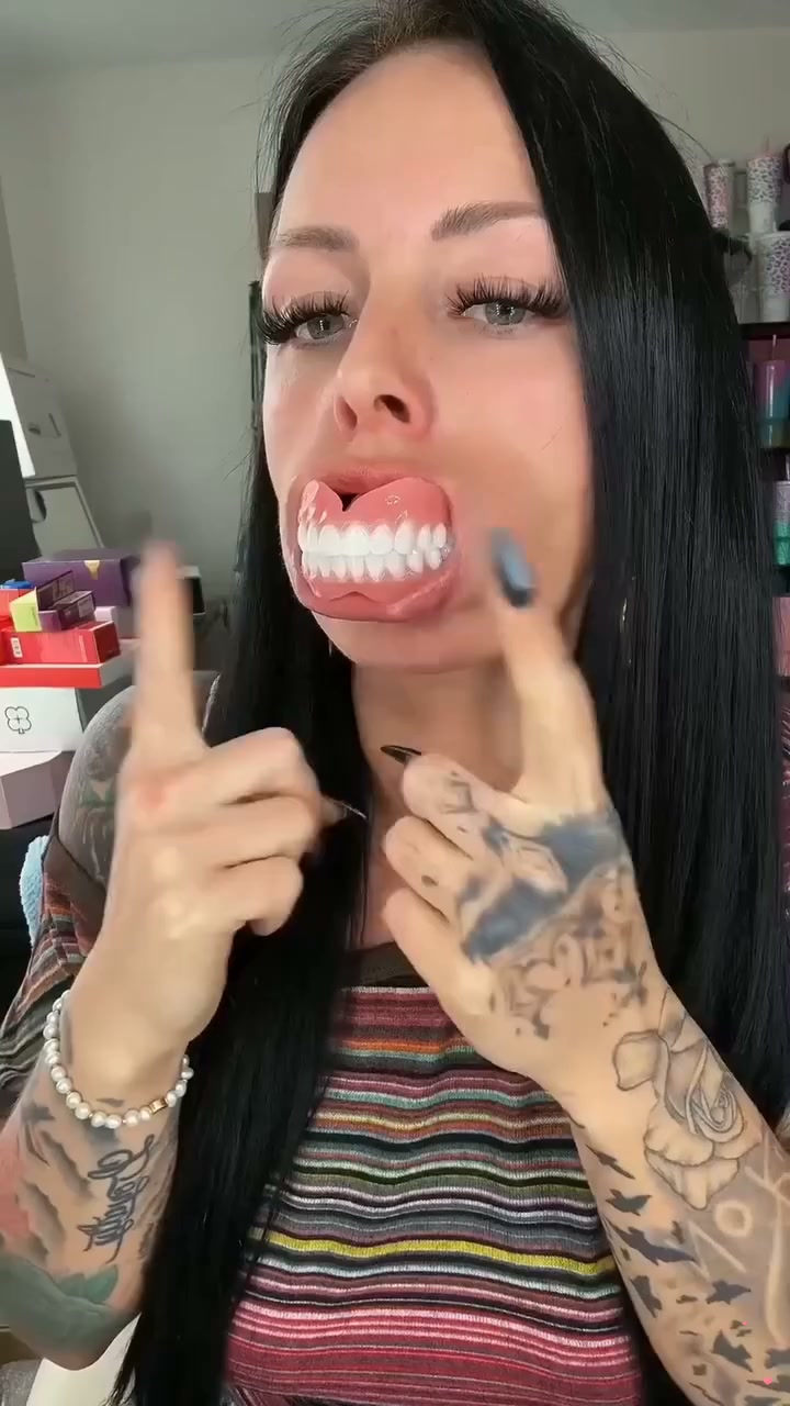 Fit Full Functional Dentures Make you more confident