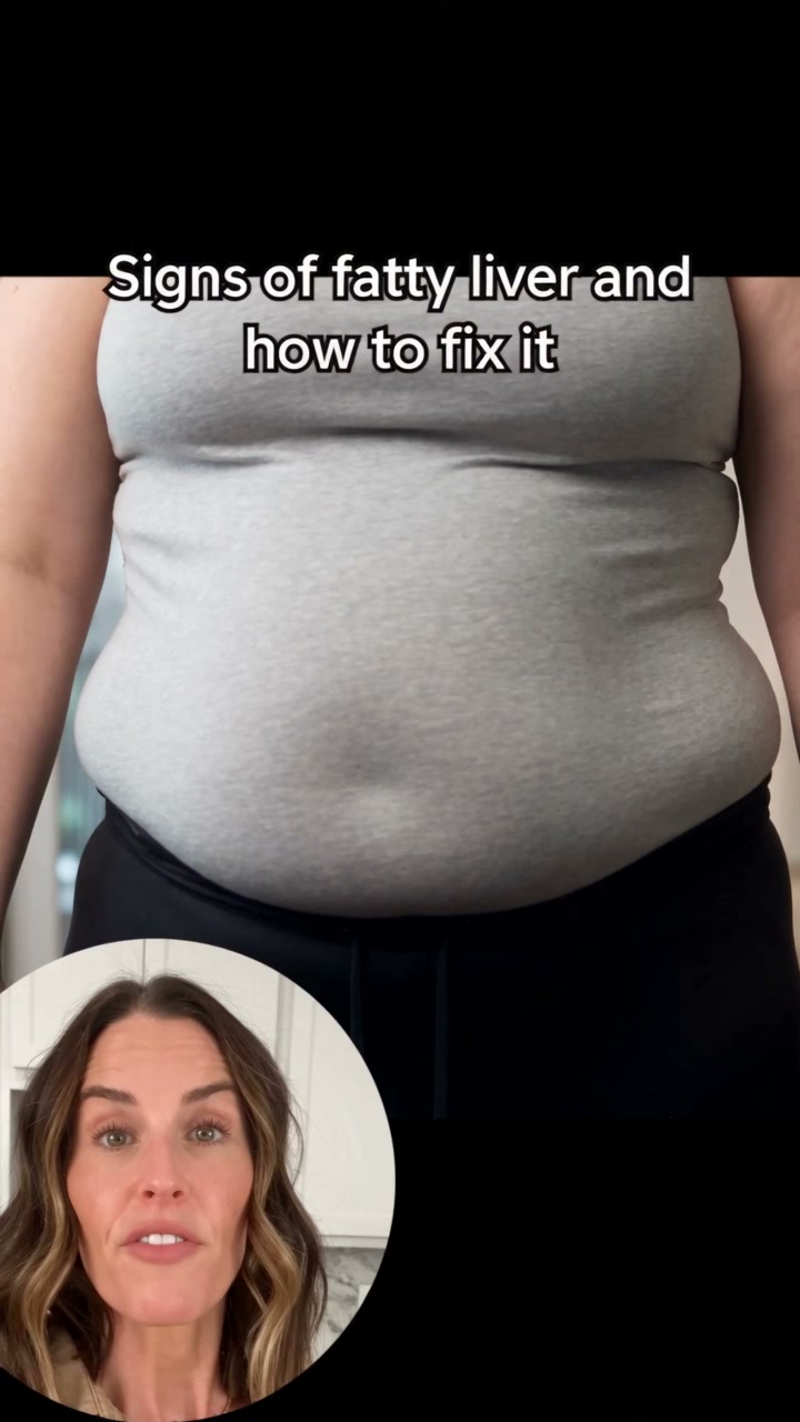 Your Face Reveals Your Health