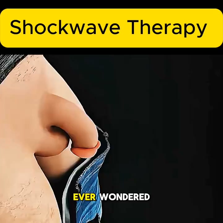 Shockwave Therapy: No surgery, no needles – pain disappears, rigidity returns.