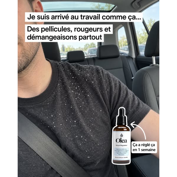 Pellicules, rougeurs, démangeaisons ? Agissez à la source.
