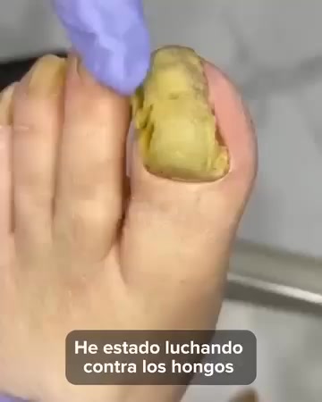 Uñas Más Fuertes y Saludables Desde Casa
