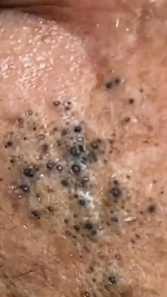 Máscara de limpeza de chá verde