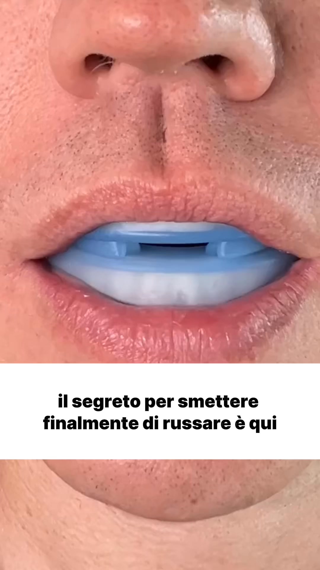 Basta Russare! Dormi Meglio!