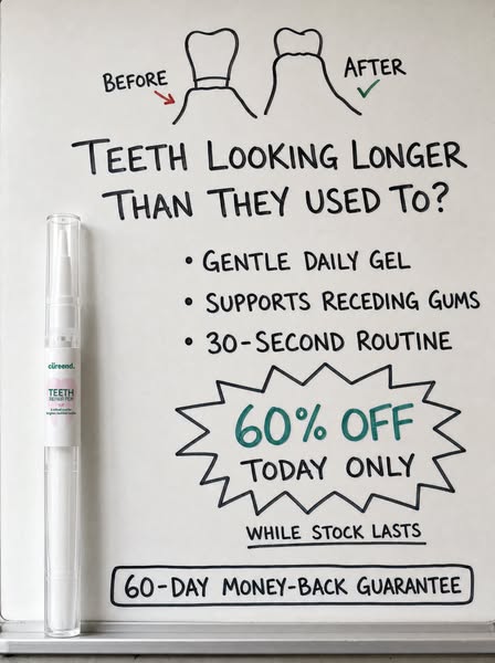 My Gums Kept Pulling Back