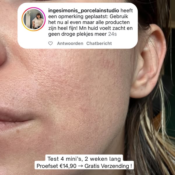 Nog 9 stuks | Proefset €14,90 + gratis verzending